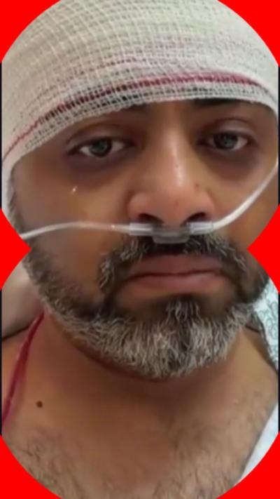 Pilot looks into the camera as he has his head bandaged and had a breathing tube in his nose